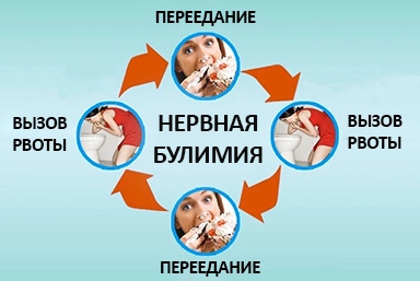 Лечение булимии в Петровск-Забайкальском